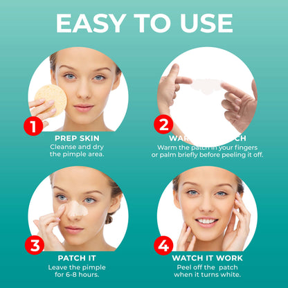 PATCHRX - NOSE PIMPLE PATCH - HYDROCOLLOID - 12 PATCHES - 4